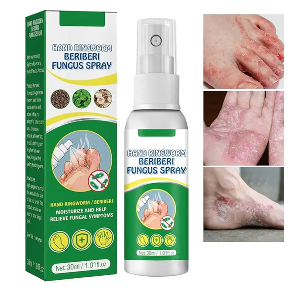 Hand Ringworm Beriberi Fungus Spray (Original) - HZ TANOLI LLC