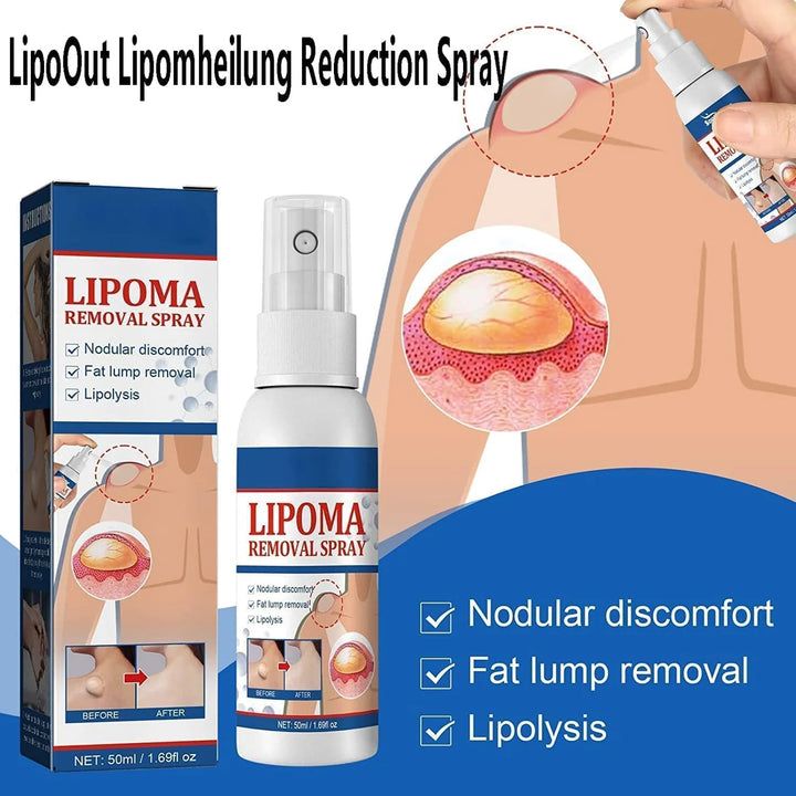 South Moon - Lipoma Removal Spray - HZ TANOLI LLC